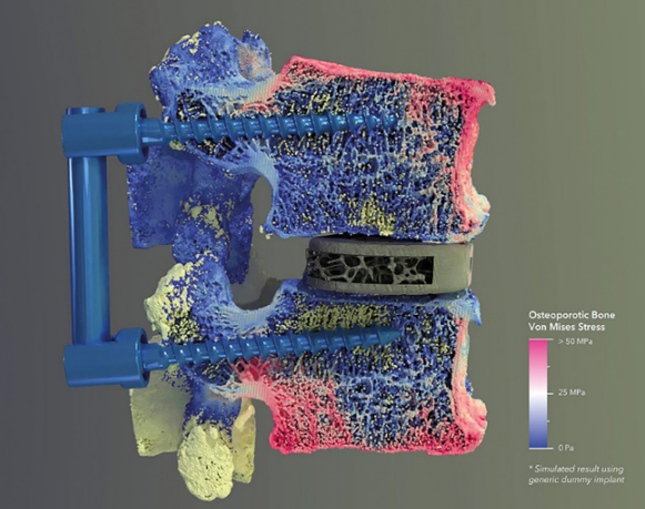 how do you test orthopedic implants?